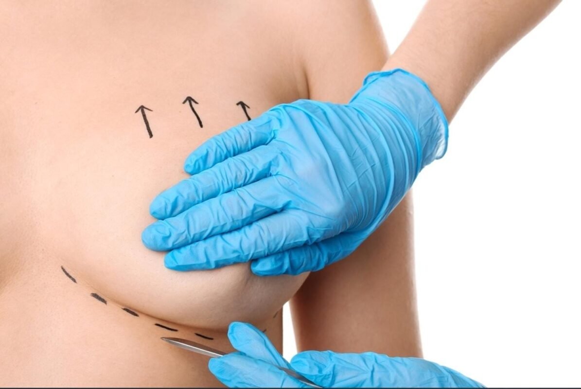 Chirurgie mammaire